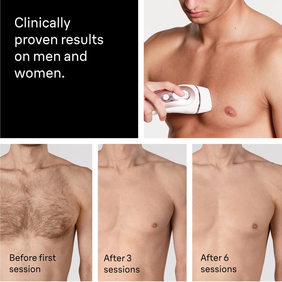 Braun Smart IPL Skin i-Expert Hair Removal Device PL7321 - White/Rose Gold - Image 8